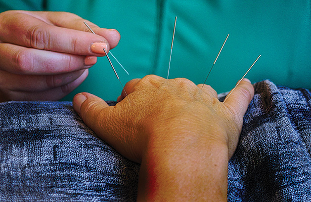 A patient receives acupuncture treatment at Balanced Being in Excelsior.